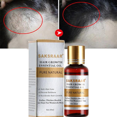 Hair Care Hair Growth Essential Oils Essence Original Authentic 100% Hair Loss Liquid Health Care Beauty Dense Hair Growth Serum